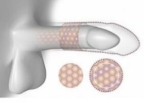 Erhéicht Penis am Volumen