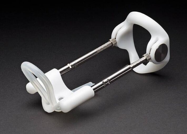 Extender no der Operatioun vun der Erliefnes Erweiderung